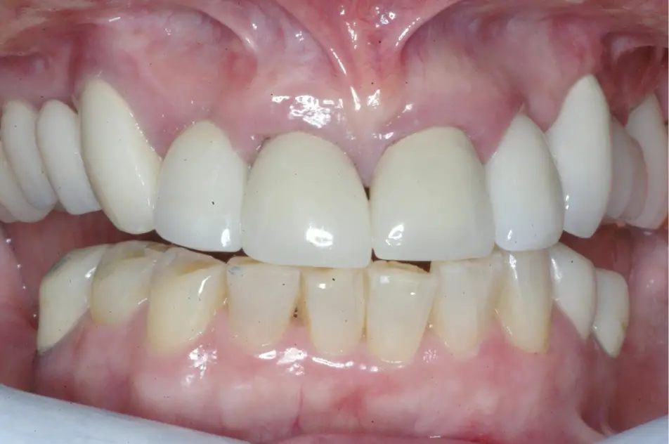 Smile Gallery