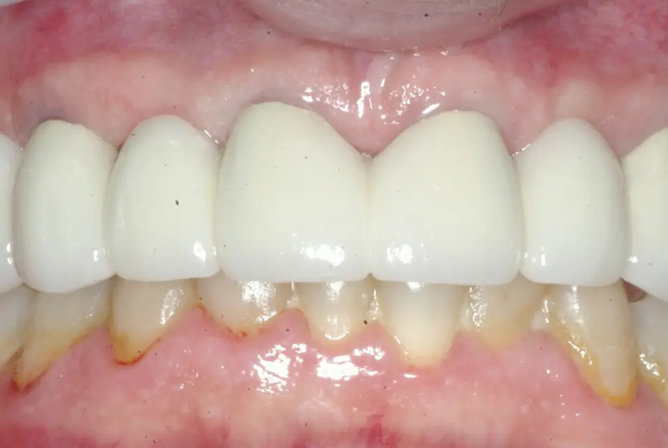 Smile Gallery