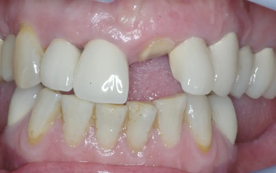 Smile Gallery
