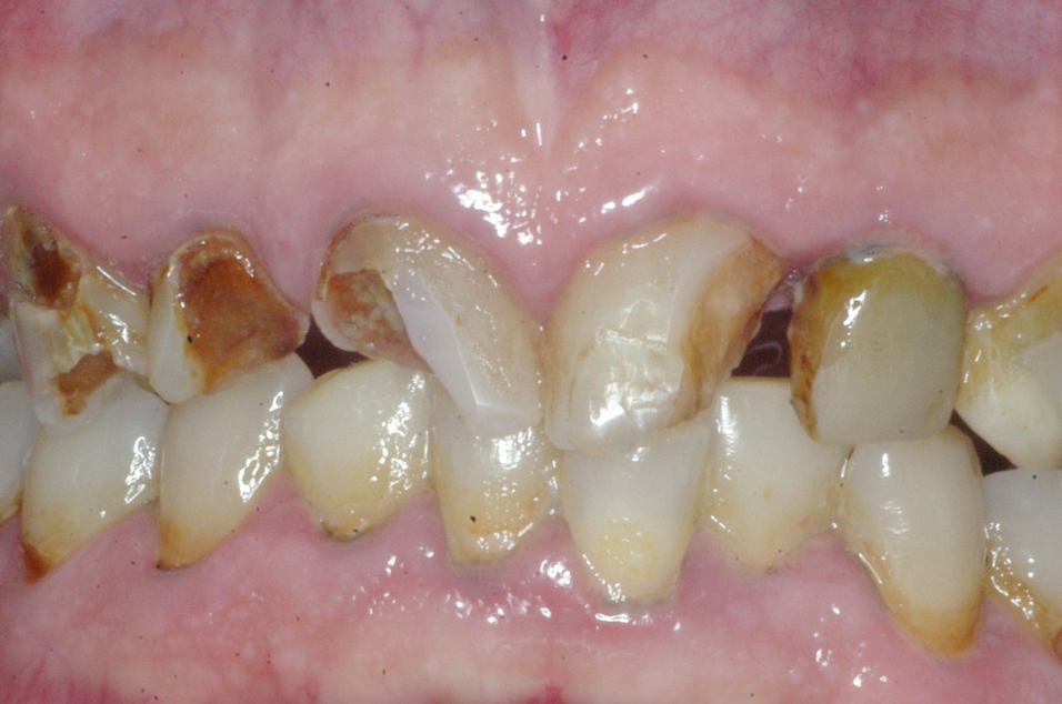 Hathorne Family Dental Hathorne Family Dental