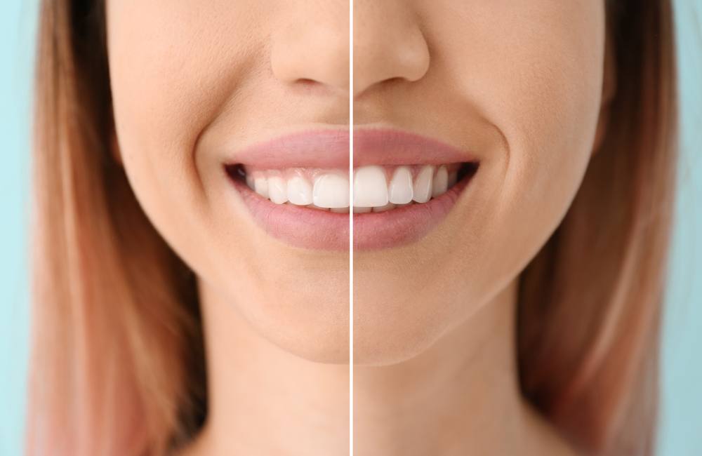 Hathorne Family Dental