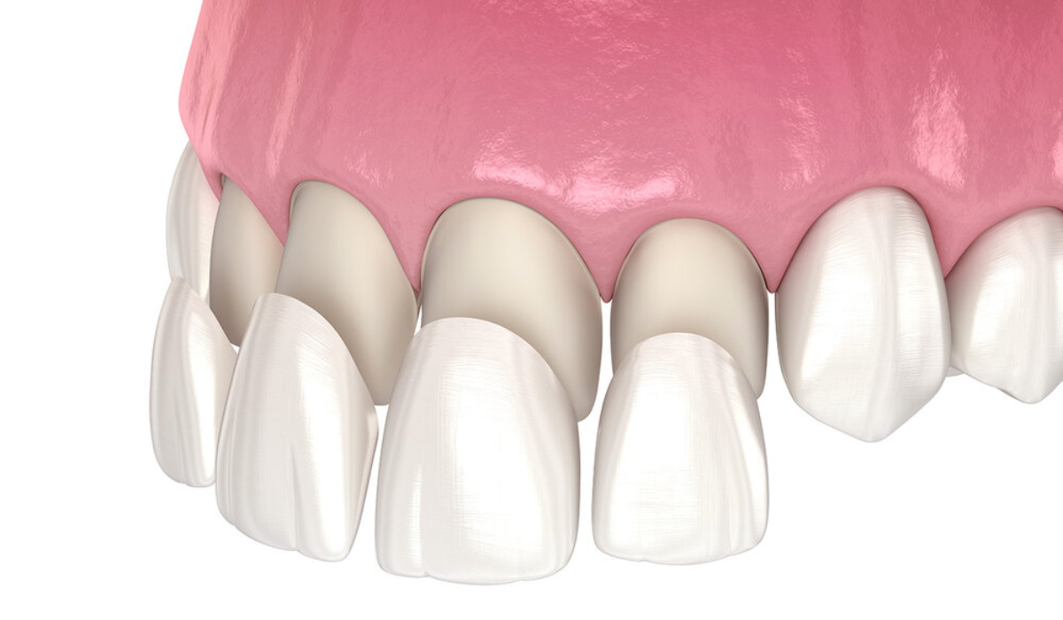 Hathorne Family Dental