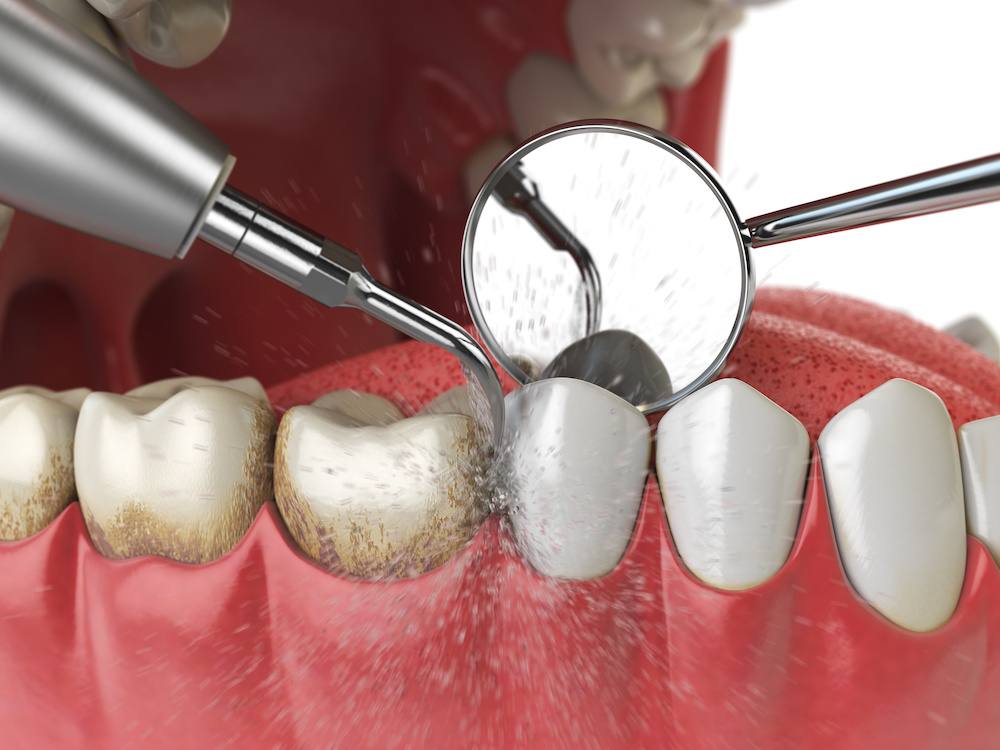 Hathorne Family Dental